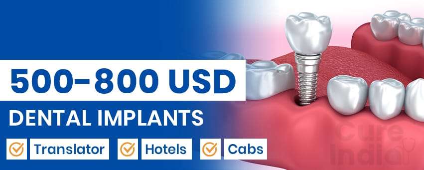 Cost for Dental Implants